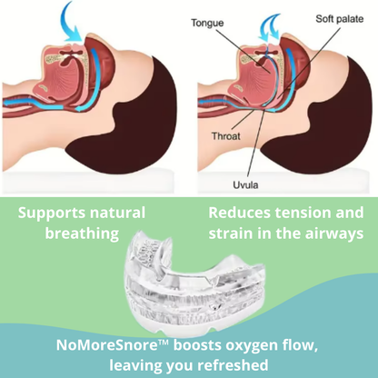 NoMoreSnore
